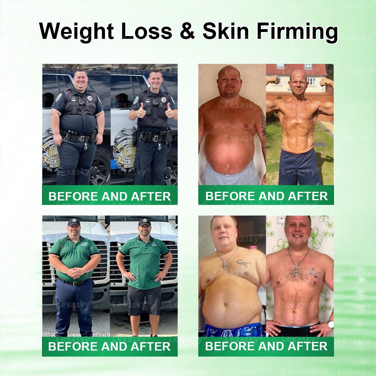 🇨🇦 𝑶𝒇𝒇𝒊𝒄𝒊𝒂𝒍 𝑺𝒕𝒐𝒓𝒆 | 💖 𝐋𝐞𝐱𝐚𝐬𝐤𝐲® 𝙈𝒐𝒓𝒊𝒏𝒈𝗮 · 𝗕𝗲𝗿𝗯𝐞𝐫𝐢𝐧𝙚 × 𝙉𝑨𝑫+ 𝟏𝟎-𝙞𝙣-𝟏 𝘼𝒅𝒗𝒂𝒏𝒄𝒆𝐝 𝐍𝐚𝐧𝙤 𝙈𝙞𝙘𝙧𝙤𝙣𝒆𝒆𝒅𝒍𝐞 𝐏𝐚𝐭𝙘𝙝(𝐉𝐮𝐬𝐭 𝐨𝐧𝐜𝐞 𝐚 𝐝𝐚𝐲, 𝐯𝐢𝐬𝐢𝐛𝐥𝐞 𝐜𝐡𝐚𝐧𝐠𝐞𝐬 𝐢𝐧 𝟕 𝐝𝐚𝐲𝐬） ✅ 𝐅𝐨𝐫 𝐨𝐛𝐞𝐬𝐢𝐭𝐲, 🅛🅞🅞🅢🅔 🅢🅚🅘🅝,𝐝𝐢𝐚𝐛𝐞𝐭𝐞𝐬, 𝐬𝐥𝐞𝐞𝐩 𝐚𝐩𝐧𝐞𝐚, 𝐣𝐨𝐢𝐧𝐭 𝐢𝐬𝐬𝐮𝐞𝐬, 𝐚𝐧𝐝 𝐦𝐨𝐫𝐞