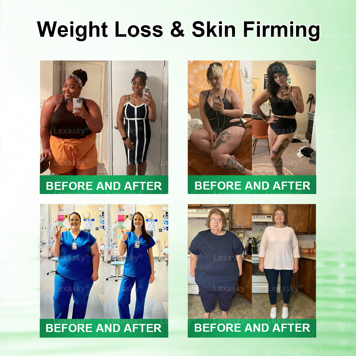 🇨🇦 𝑶𝒇𝒇𝒊𝒄𝒊𝒂𝒍 𝑺𝒕𝒐𝒓𝒆 | 💖 𝐋𝐞𝐱𝐚𝐬𝐤𝐲® 𝙈𝒐𝒓𝒊𝒏𝒈𝗮 · 𝗕𝗲𝗿𝗯𝐞𝐫𝐢𝐧𝙚 × 𝙉𝑨𝑫+ 𝟏𝟎-𝙞𝙣-𝟏 𝘼𝒅𝒗𝒂𝒏𝒄𝒆𝐝 𝐍𝐚𝐧𝙤 𝙈𝙞𝙘𝙧𝙤𝙣𝒆𝒆𝒅𝒍𝐞 𝐏𝐚𝐭𝙘𝙝(𝐉𝐮𝐬𝐭 𝐨𝐧𝐜𝐞 𝐚 𝐝𝐚𝐲, 𝐯𝐢𝐬𝐢𝐛𝐥𝐞 𝐜𝐡𝐚𝐧𝐠𝐞𝐬 𝐢𝐧 𝟕 𝐝𝐚𝐲𝐬） ✅ 𝐅𝐨𝐫 𝐨𝐛𝐞𝐬𝐢𝐭𝐲, 🅛🅞🅞🅢🅔 🅢🅚🅘🅝,𝐝𝐢𝐚𝐛𝐞𝐭𝐞𝐬, 𝐬𝐥𝐞𝐞𝐩 𝐚𝐩𝐧𝐞𝐚, 𝐣𝐨𝐢𝐧𝐭 𝐢𝐬𝐬𝐮𝐞𝐬, 𝐚𝐧𝐝 𝐦𝐨𝐫𝐞